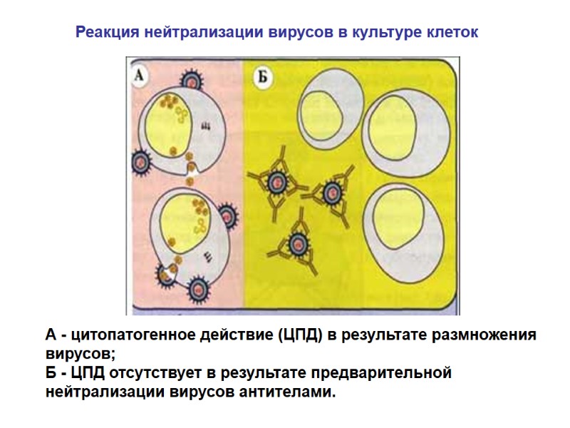 А - цитопатогенное действие (ЦПД) в результате размножения вирусов; Б - ЦПД отсутствует в